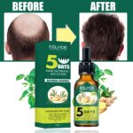 Serum protiv opadanja kose - slika 2