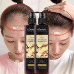 Šampon sa Đumbirom Protiv Opadanja Kose i Peruti – 2×300ml (1+1 GRATIS) - Sampon Sa Djumbirom Protiv Opadanja Kose 3.Jpg