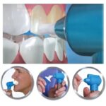 Luma Smile poliranje zuba - detalji